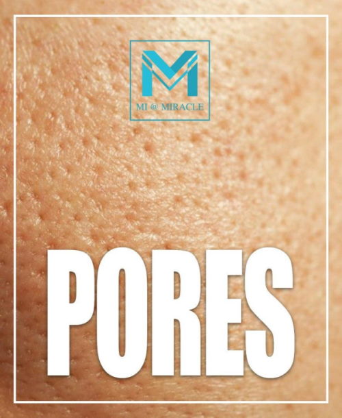 MI Pores Treatment